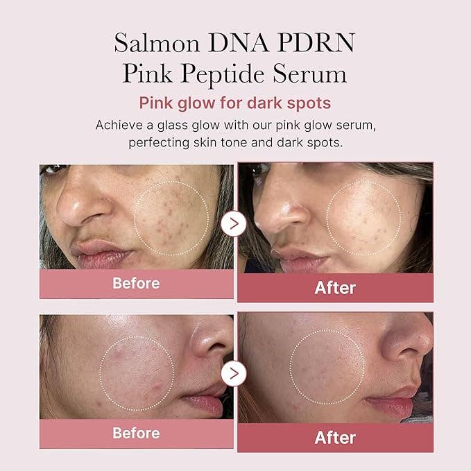 MEDICUBE Salmon DNA PDRN Pink Peptide Serum 30ml 1.01 fl.oz