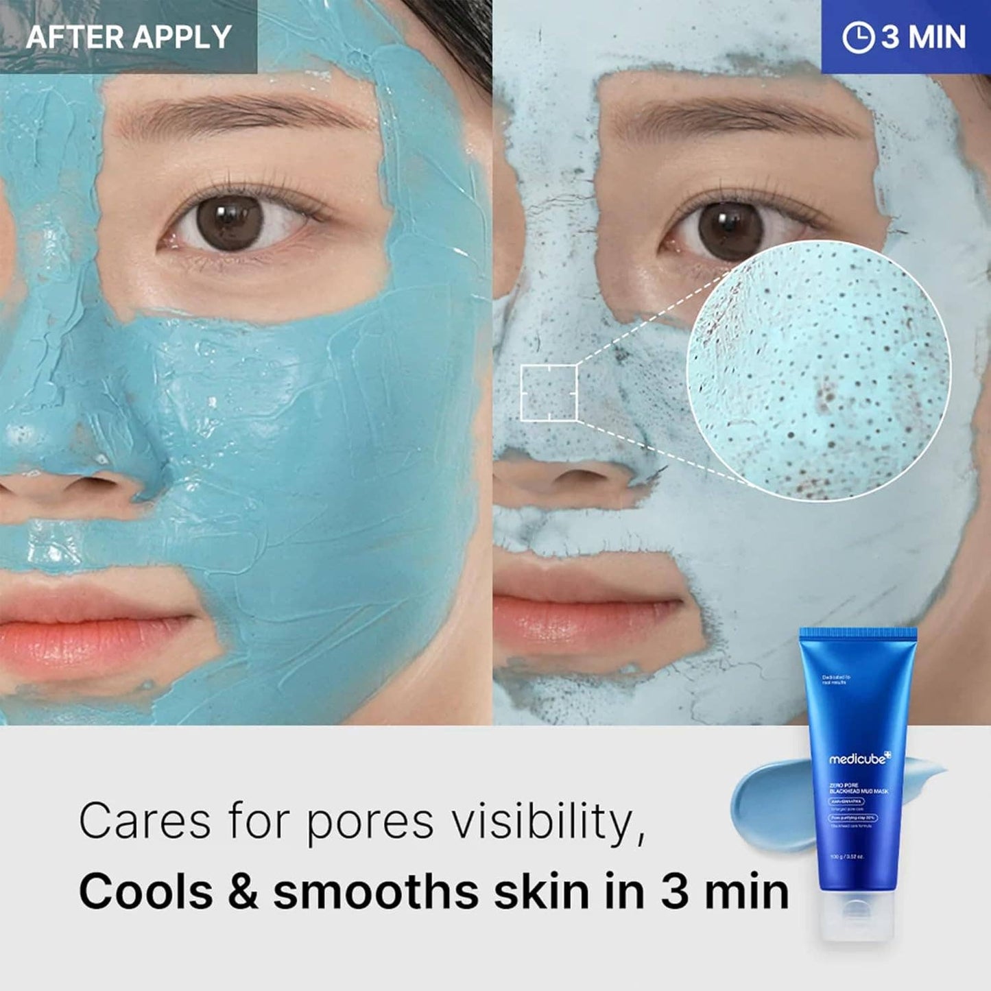 MEDICUBE Zero Pore Blackhead Mud Facial Mask 3.52 oz 100g