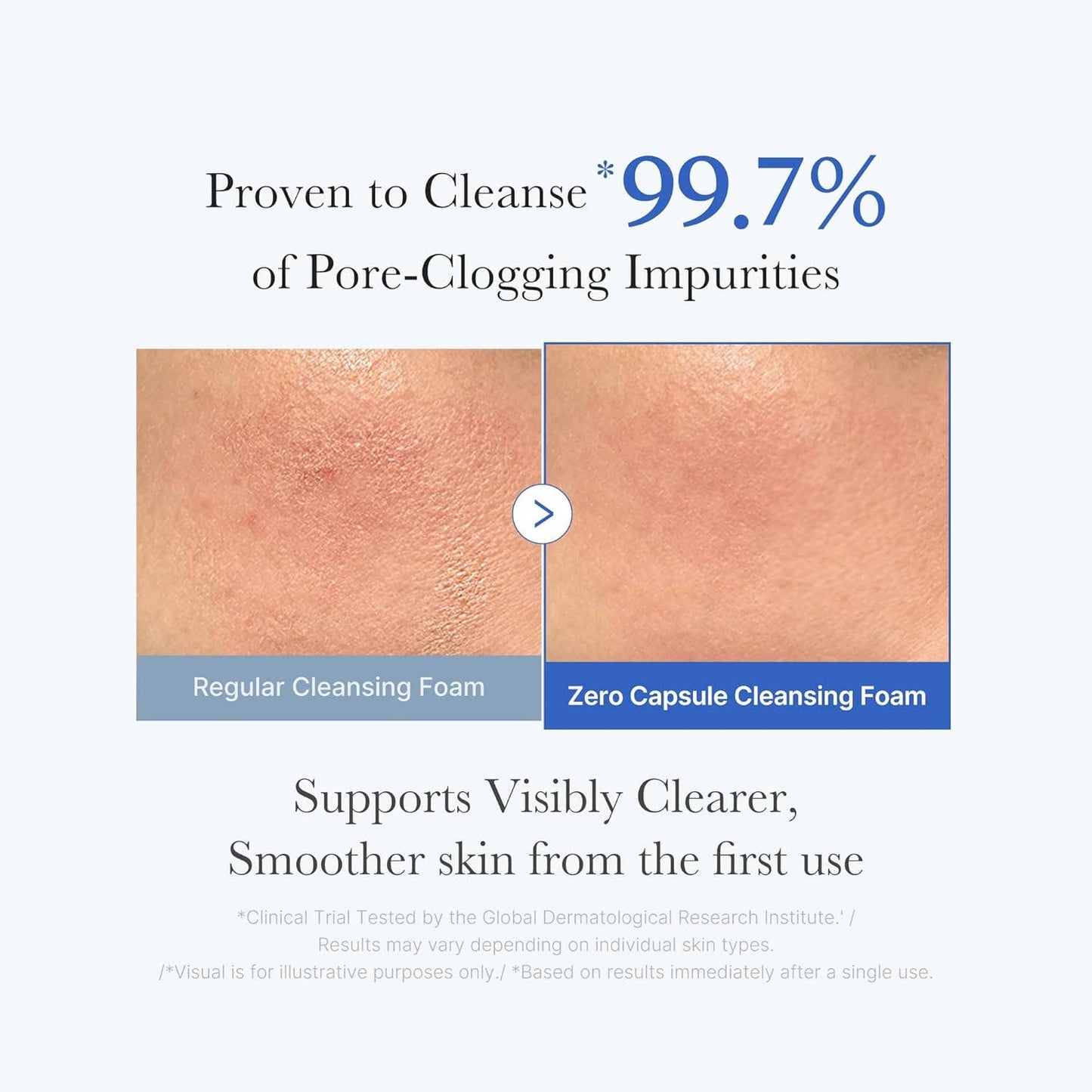 MEDICUBE Zero Pore SA Clear Capsule Cleansing Foam 120g 4.23 oz